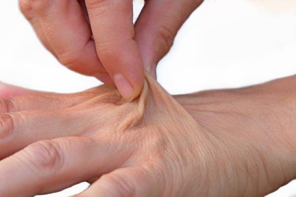 A woman's index finger and thumb pinch the skin on the back of her other hand.